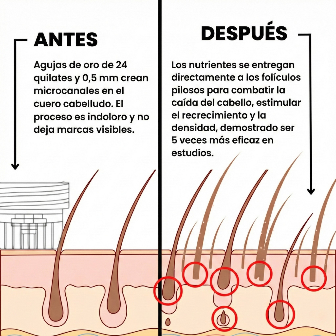 Sistema de regeneración capilar Vroin™
